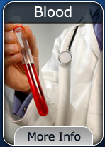 DUI Blood Test Button
