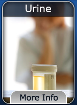 DUI Urine Test Button